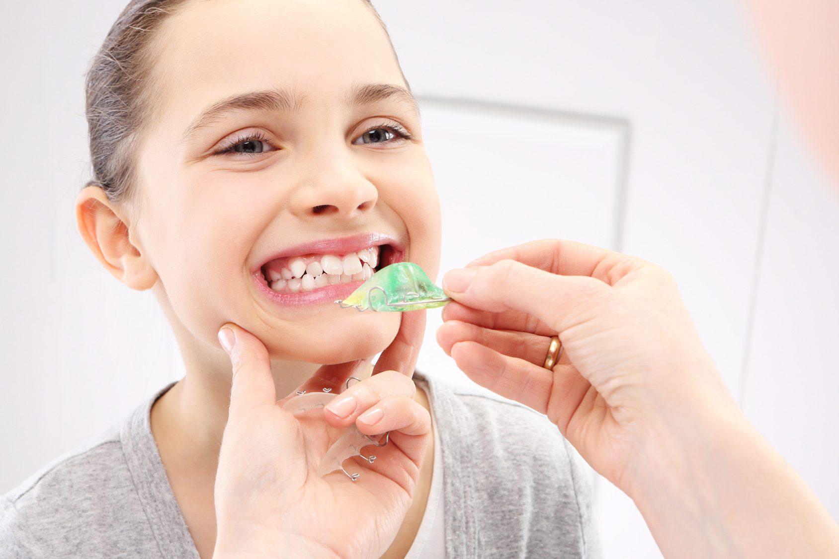 Qué es la ortodoncia preventiva