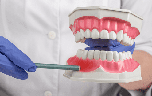 Cuánto tiempo dura un tratamiento periodontal