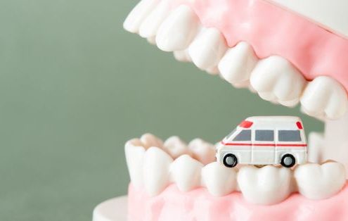 Urgencias dentales en verano