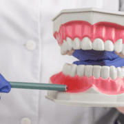 Tratamiento para la periodontitis