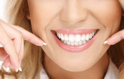 Cuidados de las Carillas dentales