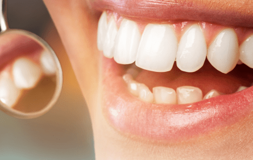 6 señales de alerta de las enfermedades periodontales