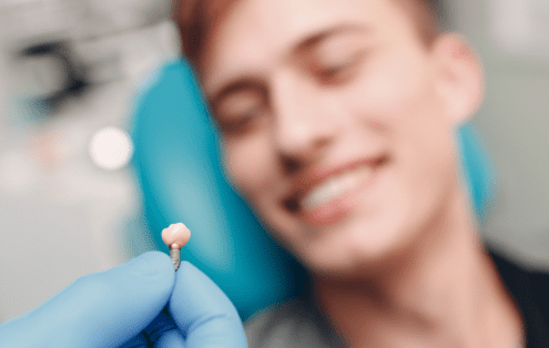 Implantes dentales sin cirugía